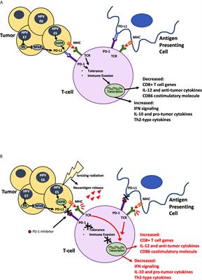 The Incorporation of Immunotherapy and Targeted Therapy Into Chemoradiation for Cervical Cancer: A Focused Review